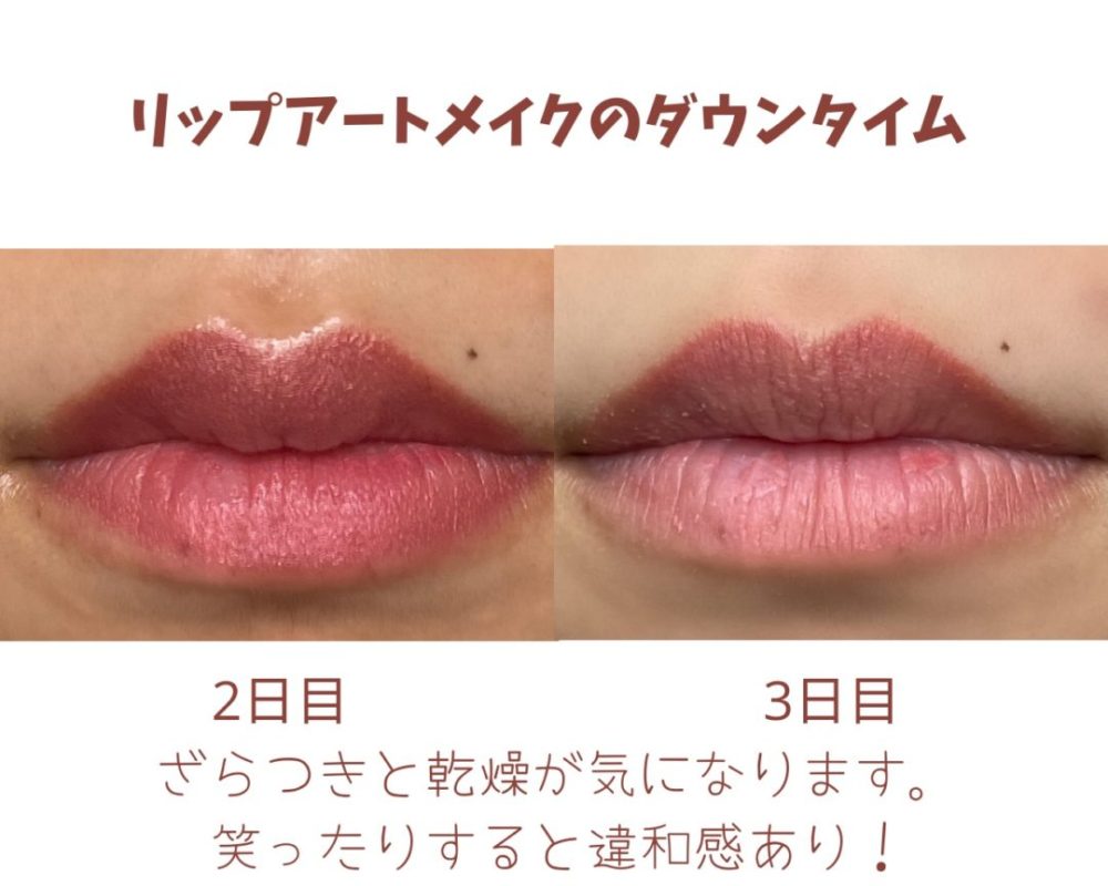 Lip Blush Healing