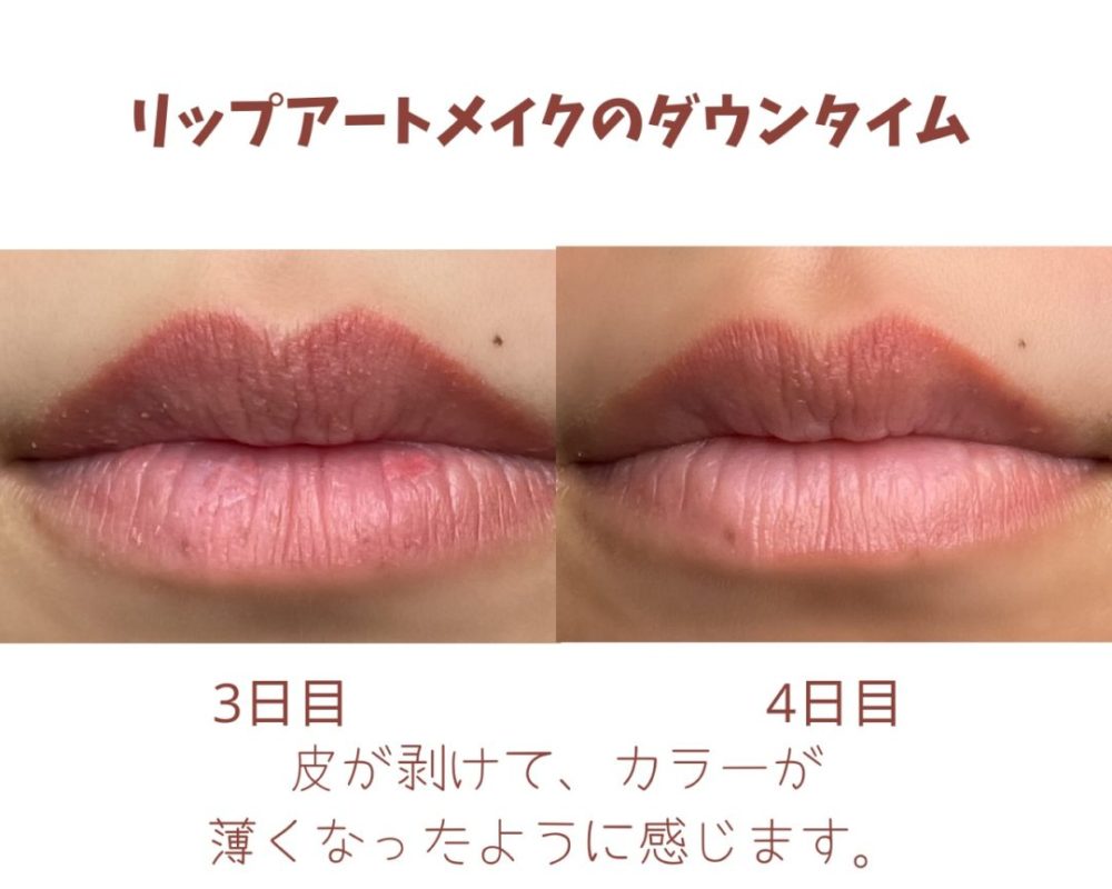 Lip Blush Healing